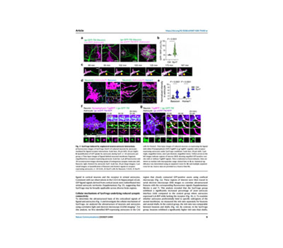 High resolution live cell imaging-time lapse