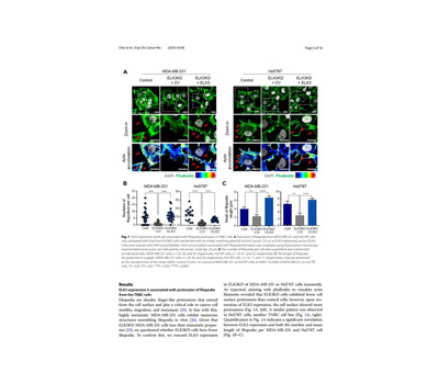 Time‑lapse observation of the actin accumulation