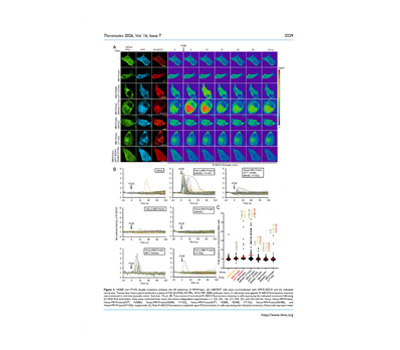 Ultrasound-coupled Live Calcium Imaging(FRET, TIRF)